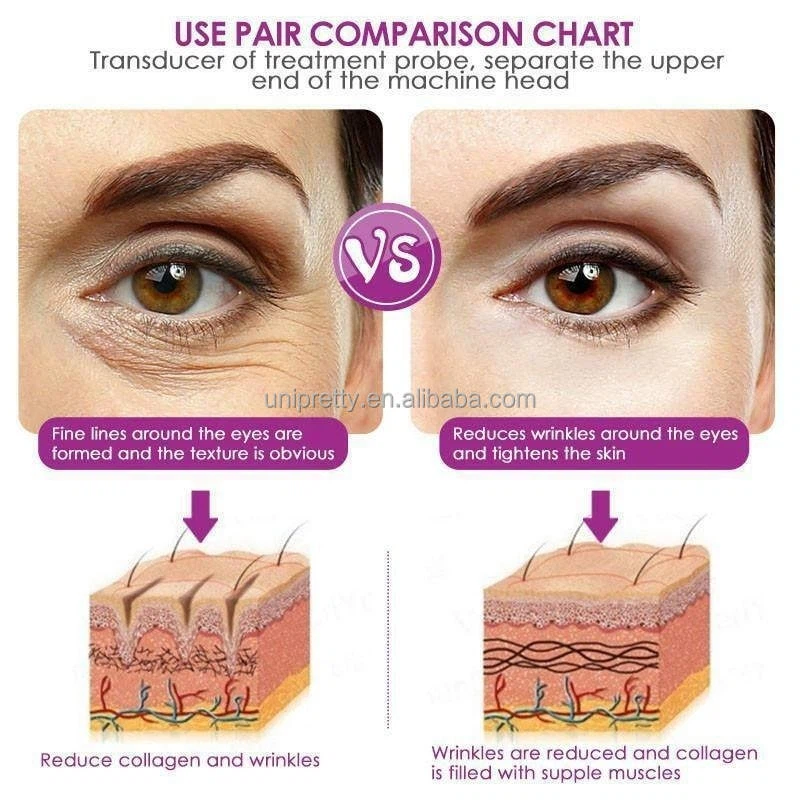 morpheus 8 fractional machine 3 morpheus 8 fractional machine 3