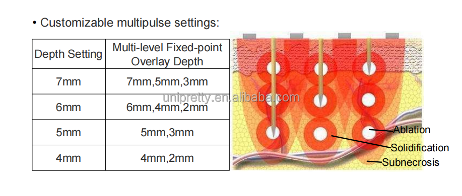 morpheus 8 fractional machine 4 morpheus 8 fractional machine 4