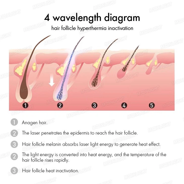 Best Professional Laser Hair Removal Machine Price