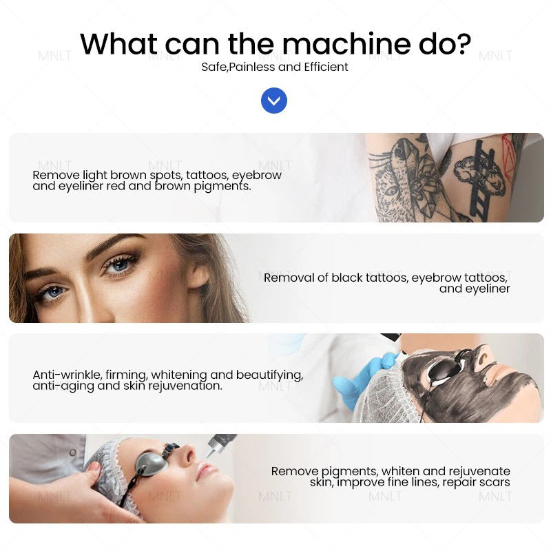 Nd Yag Tattoo Removal Machine